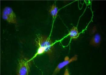 جلوگیری از مرگ نورونها در آلزایمر با یک داروی رایج